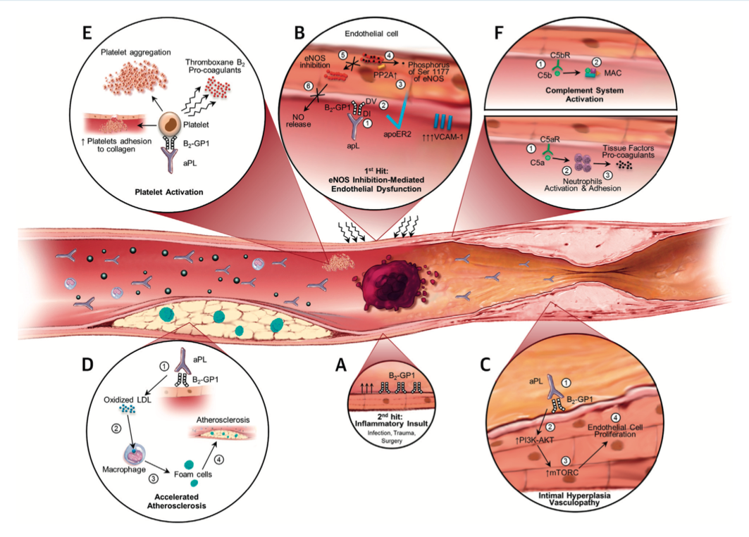 Lupus anticoagulant