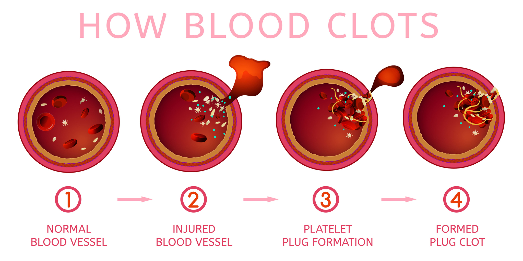 Blood clotting process Kaleidoscope Fighting Lupus